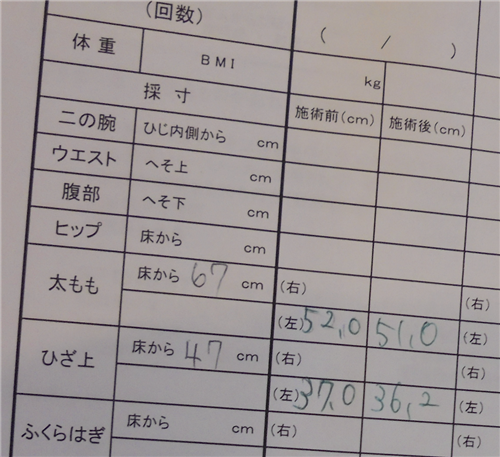 <% pageTitle %>” /></p>
<p><strong>太ももの上のほう→ 1センチ減！</strong><br />
<strong>太もものひざに近いところ→ 8ミリ減！</strong><br />
となりました。<br />
これ、たった1回、1時間ほどの体験での結果です。<br />
何回か続けていくとすごいことになるかも、という予感が。<br />
体験を受けた感想は、<br />
「痩身をやりたくなっちゃった」です。<br />
さあそれではここから、ヴィトゥレの体験談をスタートしていきましょう。<br />
皆さんが疑問に思っているであろうことも、しっかりと聞いてきました。</p>
<h4><span id=